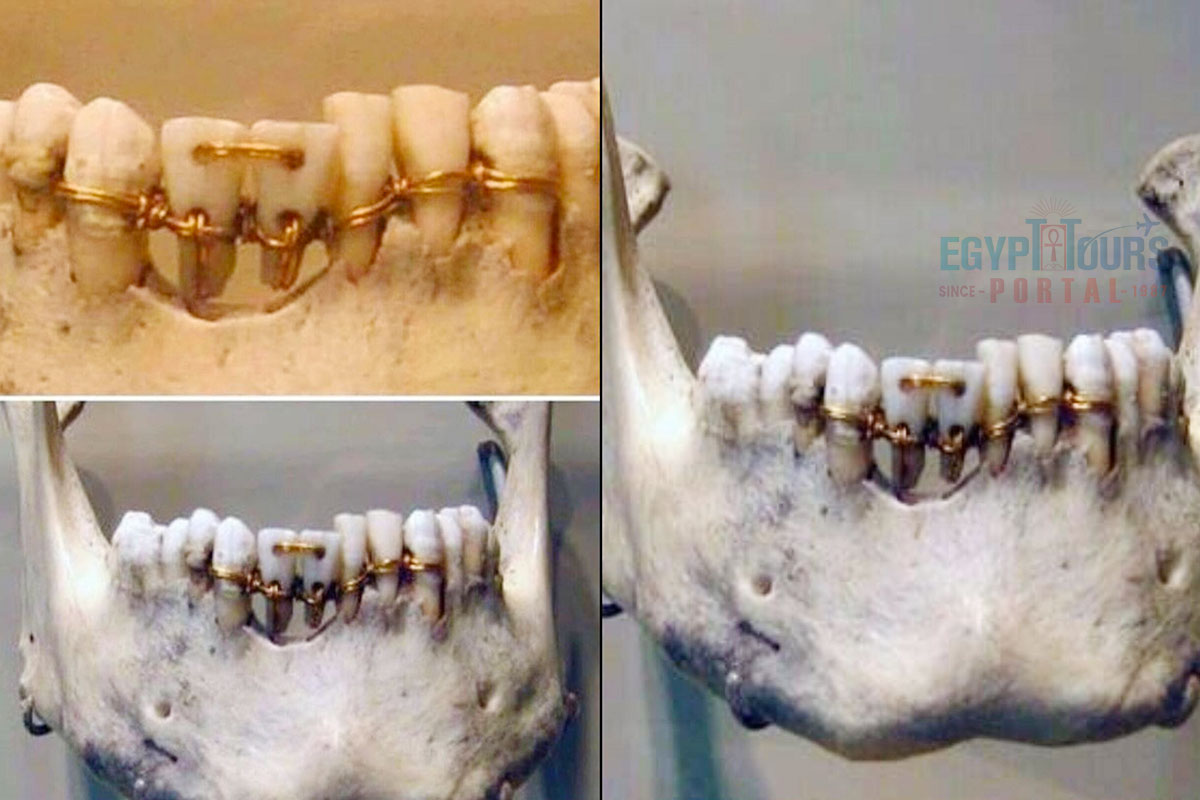 Dentistry in Ancient Egypt - Egypt Tours Portal